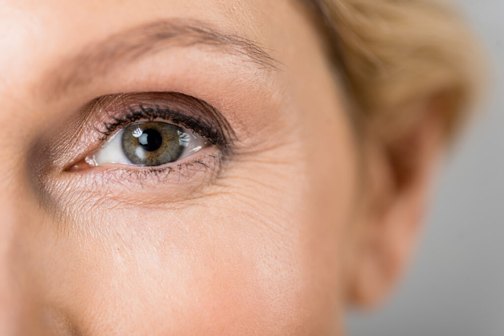 Close-up of woman's eye showing fine lines and wrinkles.